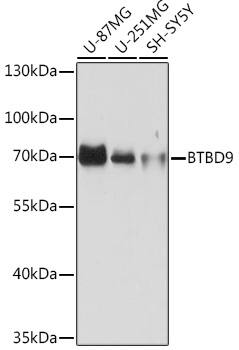 Western Blot: BTBD9 Antibody [NBP3-35864] - Western blot analysis of various lysates using BTBD9 Rabbit pAb at 1:1000 dilution.Secondary antibody: HRP-conjugated Goat anti-Rabbit IgG (H+L) at 1:10000 dilution.Lysates/proteins: 25ug per lane.Blocking buffer: 3% nonfat dry milk in TBST.Detection: ECL Basic Kit.Exposure time: 5s.