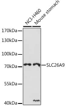 Western Blot: SLC26A9 Antibody [NBP3-35865] - Western blot analysis of various lysates using SLC26A9 Rabbit pAb at 1:1000 dilution.Secondary antibody: HRP-conjugated Goat anti-Rabbit IgG (H+L) at 1:10000 dilution.Lysates/proteins: 25ug per lane.Blocking buffer: 3% nonfat dry milk in TBST.Detection: ECL Basic Kit.Exposure time: 90s.