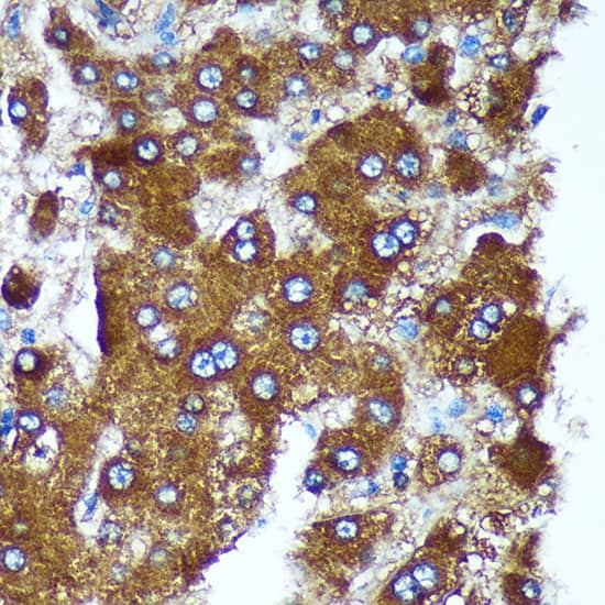 Immunohistochemistry PIGU Antibody