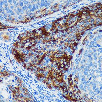 Immunohistochemistry PIGU Antibody