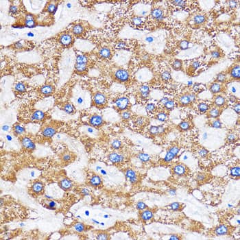 Immunohistochemistry: MITD1 Antibody [NBP3-35868] - Immunohistochemistry analysis of paraffin-embedded Human liver using MITD1 Rabbit pAb at dilution of 1:100 (40x lens). Microwave antigen retrieval performed with 0.01M PBS Buffer (pH 7.2) prior to IHC staining.