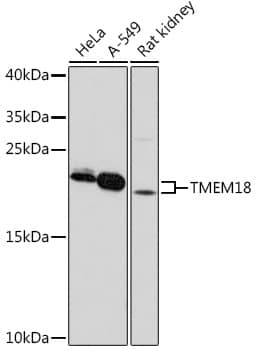 Western Blot: TMEM18 Antibody [NBP3-35869] - Western blot analysis of various lysates using TMEM18at 1:1000 dilution.Secondary antibody: HRP-conjugated Goat anti-Rabbit IgG (H+L) at 1:10000 dilution.Lysates/proteins: 25ug per lane.Blocking buffer: 3% nonfat dry milk in TBST.Detection: ECL Basic Kit.Exposure time: 3min.