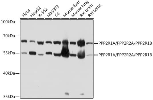 Western Blot: PPP2R1A Antibody [NBP3-35877] - Western blot analysis of various lysates using PPP2R1A Rabbit pAb at 1:1000 dilution.Secondary antibody: HRP-conjugated Goat anti-Rabbit IgG (H+L) at 1:10000 dilution.Lysates/proteins: 25ug per lane.Blocking buffer: 3% nonfat dry milk in TBST.Detection: ECL Basic Kit.Exposure time: 10s.