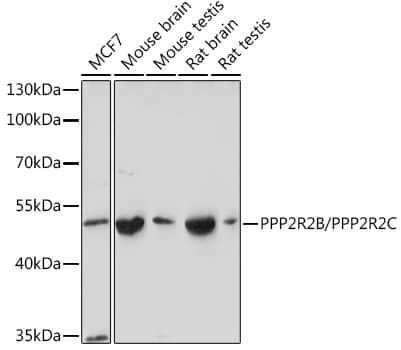 Western Blot: PPP2R2B Antibody [NBP3-35878] - Western blot analysis of various lysates using PPP2R2B Rabbit pAb at 1:1000 dilution.Secondary antibody: HRP-conjugated Goat anti-Rabbit IgG (H+L) at 1:10000 dilution.Lysates/proteins: 25ug per lane.Blocking buffer: 3% nonfat dry milk in TBST.Detection: ECL Basic Kit.Exposure time: 5s.