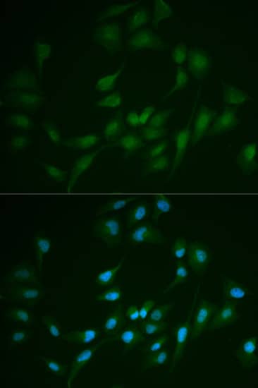 Immunocytochemistry/ Immunofluorescence: DNA Ligase I Antibody [NBP3-35879] - Immunofluorescence analysis of MCF-7 cells using DNA Ligase I Rabbit pAb. Secondary antibody: Cy3-conjugated Goat anti-Rabbit IgG (H+L) at 1:500 dilution. Blue: DAPI for nuclear staining.