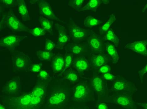 Immunocytochemistry/ Immunofluorescence: DNA Ligase I Antibody [NBP3-35879] - Immunofluorescence analysis of A549 cells using DNA Ligase I Rabbit pAb.Secondary antibody: Cy3-conjugated Goat anti-Rabbit IgG (H+L) at 1:500 dilution.
