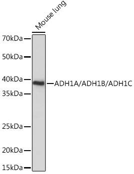 Western Blot alcohol dehydrogenase Antibody