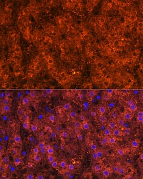 Immunocytochemistry/ Immunofluorescence: alcohol dehydrogenase Antibody [NBP3-35880] - Immunofluorescence analysis of paraffin-embedded Human liver using alcohol dehydrogenase Rabbit pAb at dilution of 1:100. Secondary antibody: Cy3-conjugated Goat anti-Rabbit IgG (H+L) at 1:500 dilution. Blue: DAPI for nuclear staining.