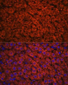 Immunocytochemistry/ Immunofluorescence alcohol dehydrogenase Antibody