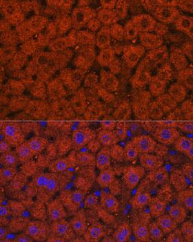 Immunocytochemistry/ Immunofluorescence alcohol dehydrogenase Antibody