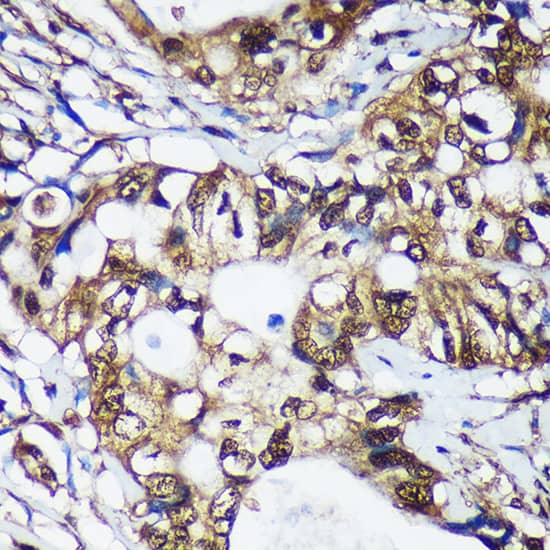 Immunohistochemistry Translin Antibody