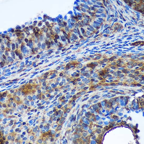 Immunohistochemistry Translin Antibody