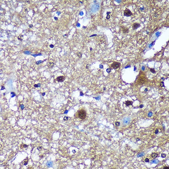 Immunohistochemistry Translin Antibody