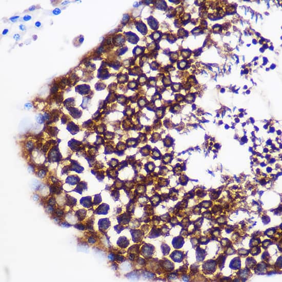 Immunohistochemistry: Prostaglandin E Synthase Antibody [NBP3-35883] - Immunohistochemistry analysis of paraffin-embedded Rat testis using Prostaglandin E Synthase Rabbit pAb at dilution of 1:100 (40x lens). Microwave antigen retrieval performed with 0.01M PBS Buffer (pH 7.2) prior to IHC staining.