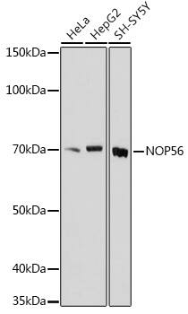 Western Blot: NOP56 Antibody [NBP3-35887] - Western blot analysis of various lysates using NOP56 Rabbit pAb at 1:1000 dilution.Secondary antibody: HRP-conjugated Goat anti-Rabbit IgG (H+L) at 1:10000 dilution.Lysates/proteins: 25ug per lane.Blocking buffer: 3% nonfat dry milk in TBST.Detection: ECL Basic Kit.Exposure time: 180s.