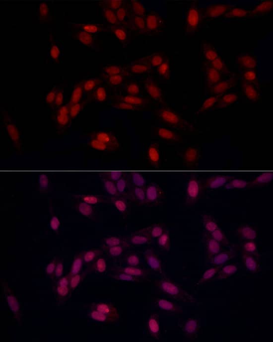 Immunocytochemistry/ Immunofluorescence SUPT16H Antibody