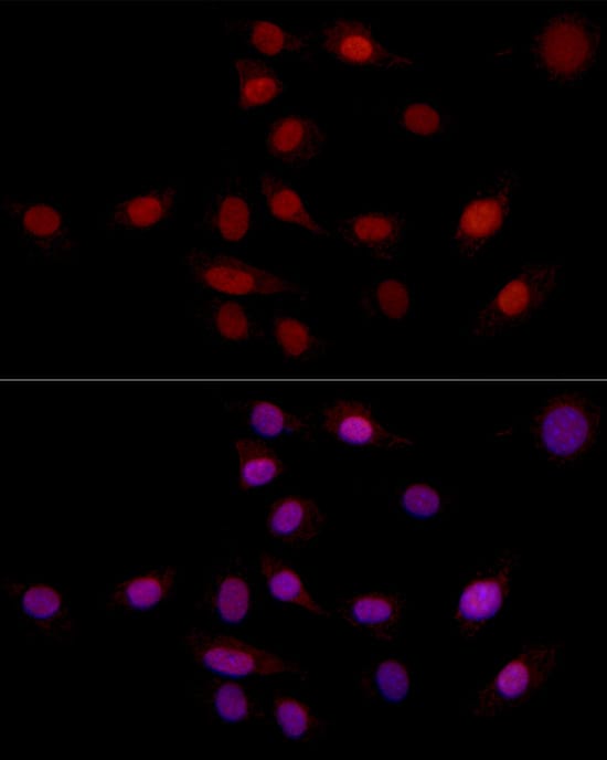 Immunocytochemistry/ Immunofluorescence SUPT16H Antibody