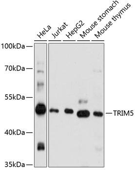 Western Blot: TRIM5 alpha Antibody [NBP3-35889] - Western blot analysis of various lysates using TRIM5 alpha Rabbit pAb at 1:1000 dilution.Secondary antibody: HRP-conjugated Goat anti-Rabbit IgG (H+L) at 1:10000 dilution.Lysates/proteins: 25ug per lane.Blocking buffer: 3% nonfat dry milk in TBST.Detection: ECL Basic Kit.Exposure time: 60s.