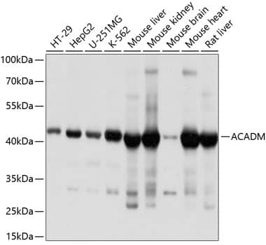 Western Blot: ACADM Antibody [NBP3-35890] - Western blot analysis of various lysates using ACADM Rabbit pAb at 1:1000 dilution.Secondary antibody: HRP-conjugated Goat anti-Rabbit IgG (H+L) at 1:10000 dilution.Lysates/proteins: 25ug per lane.Blocking buffer: 3% nonfat dry milk in TBST.Detection: ECL Basic Kit.Exposure time: 1s.