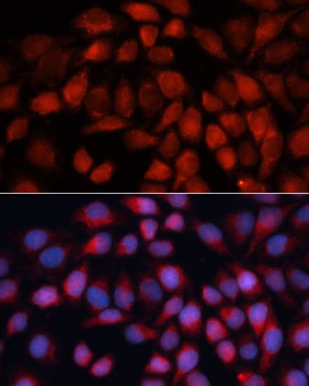 Immunocytochemistry/ Immunofluorescence: ACADM Antibody [NBP3-35890] - Immunofluorescence analysis of HeLa cells using ACADM Rabbit pAb at dilution of 1:100 (40x lens). Secondary antibody: Cy3-conjugated Goat anti-Rabbit IgG (H+L) at 1:500 dilution. Blue: DAPI for nuclear staining.