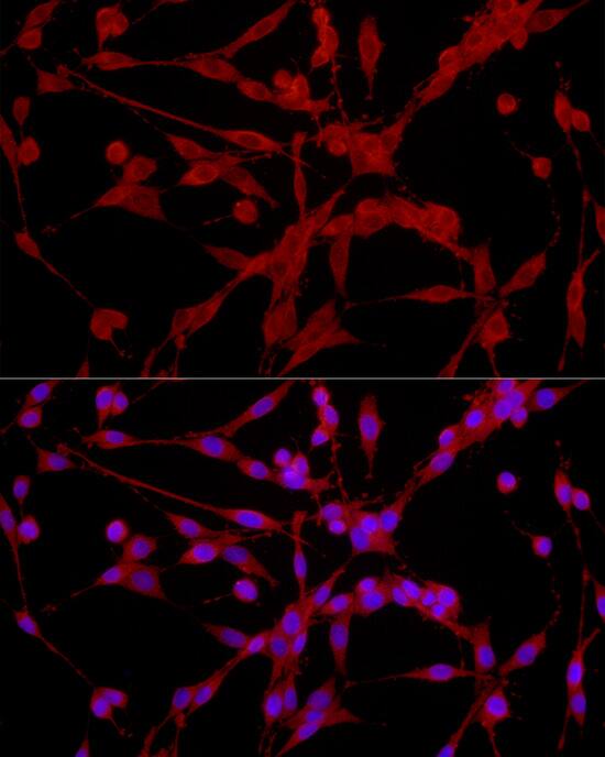 Immunocytochemistry/ Immunofluorescence: EPHX2 Antibody [NBP3-35892] - Immunofluorescence analysis of PC-12 cells using EPHX2 Rabbit pAb at dilution of 1:200 (40x lens). Secondary antibody: Cy3-conjugated Goat anti-Rabbit IgG (H+L) at 1:500 dilution. Blue: DAPI for nuclear staining.