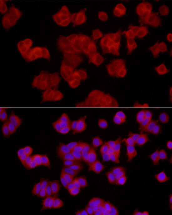 Immunocytochemistry/ Immunofluorescence: EPHX2 Antibody [NBP3-35892] - Immunofluorescence analysis of MCF7 cells using EPHX2 Rabbit pAb at dilution of 1:200 (40x lens). Secondary antibody: Cy3-conjugated Goat anti-Rabbit IgG (H+L) at 1:500 dilution. Blue: DAPI for nuclear staining.