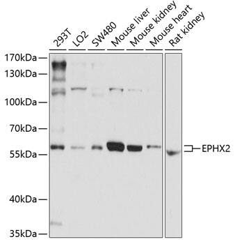 Western Blot: EPHX2 Antibody [NBP3-35892] - Western blot analysis of various lysates using EPHX2 Rabbit pAb at 1:1000 dilution.Secondary antibody: HRP-conjugated Goat anti-Rabbit IgG (H+L) at 1:10000 dilution.Lysates/proteins: 25ug per lane.Blocking buffer: 3% nonfat dry milk in TBST.Detection: ECL Enhanced Kit.Exposure time: 30s.