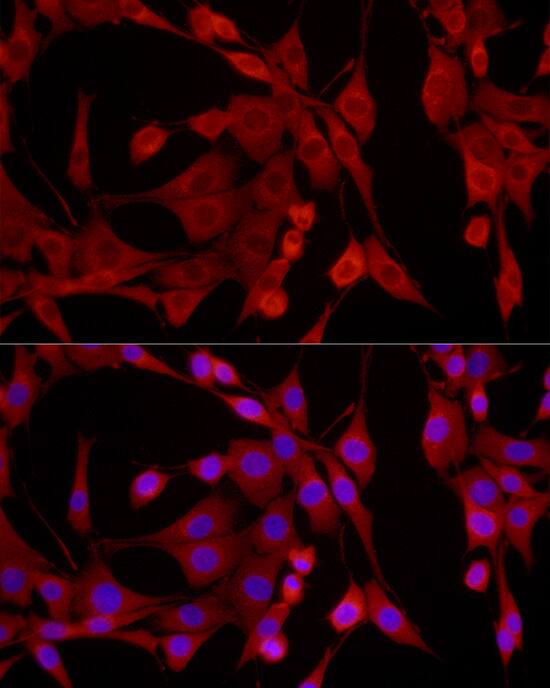 Immunocytochemistry/ Immunofluorescence: EPHX2 Antibody [NBP3-35892] - Immunofluorescence analysis of NIH/3T3 cells using EPHX2 Rabbit pAb at dilution of 1:200 (40x lens). Secondary antibody: Cy3-conjugated Goat anti-Rabbit IgG (H+L) at 1:500 dilution. Blue: DAPI for nuclear staining.