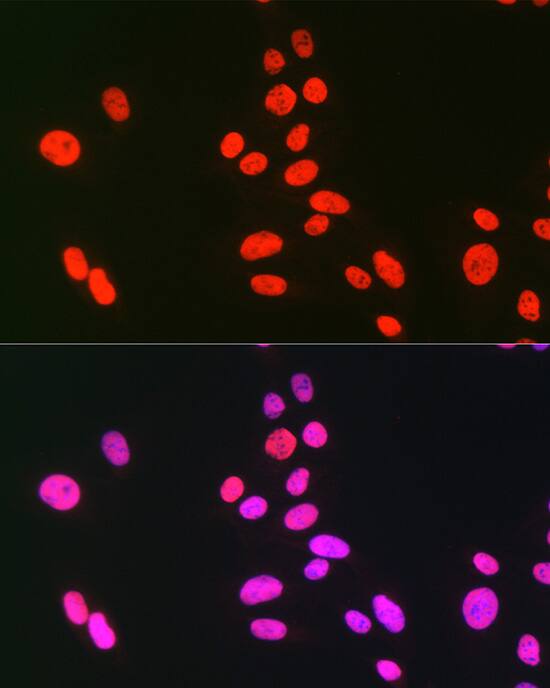 Immunocytochemistry/ Immunofluorescence: hnRNP C1 + C2 Antibody [NBP3-35893] - Immunofluorescence analysis of U-2 OS cells using hnRNP C1 + C2 Rabbit pAb at dilution of 1:100 (40x lens). Secondary antibody: Cy3-conjugated Goat anti-Rabbit IgG (H+L) at 1:500 dilution. Blue: DAPI for nuclear staining.