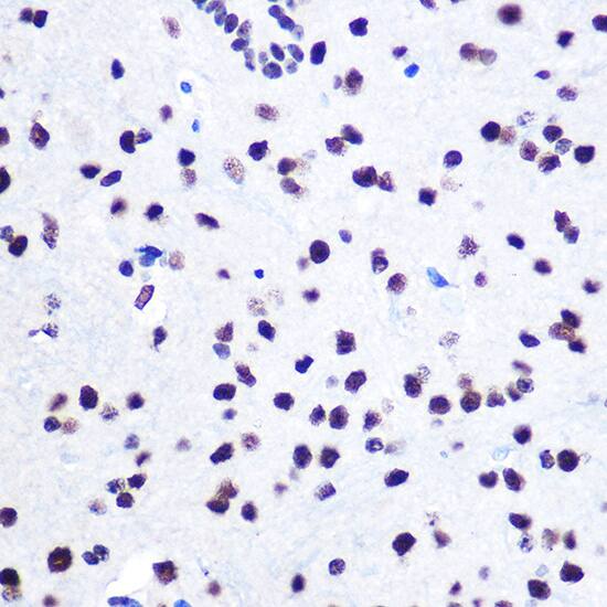 Immunohistochemistry: hnRNP C1 + C2 Antibody [NBP3-35893] - Immunohistochemistry analysis of paraffin-embedded Mouse spinal cord using hnRNP C1 + C2 Rabbit pAb at dilution of 1:100 (40x lens). Microwave antigen retrieval performed with 0.01M Tris/EDTA Buffer (pH 9.0) prior to IHC staining.