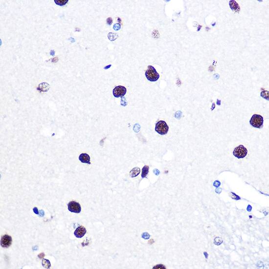 Immunohistochemistry: hnRNP C1 + C2 Antibody [NBP3-35893] - Immunohistochemistry analysis of paraffin-embedded Human brain using hnRNP C1 + C2 Rabbit pAb at dilution of 1:100 (40x lens). Microwave antigen retrieval performed with 0.01M Tris/EDTA Buffer (pH 9.0) prior to IHC staining.