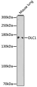 Western Blot: DLC1 Antibody [NBP3-35894] - Western blot analysis of lysates from mouse lung, using DLC1 Rabbit pAb at 1:1000 dilution.Secondary antibody: HRP-conjugated Goat anti-Rabbit IgG (H+L) at 1:10000 dilution.Lysates/proteins: 25ug per lane.Blocking buffer: 3% nonfat dry milk in TBST.Detection: ECL Enhanced Kit.