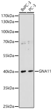 Western Blot: GNA11 Antibody [NBP3-35896] - Western Blot analysis of various lysates using GNA11 Rabbit pAb at 1:1000 dilution. Secondary antibody: HRP Goat Anti-Rabbit IgG (H+L) at 1:10000 dilution. Lysates / proteins: 25 ug per lane. Blocking buffer: 3 % nonfat dry milk in TBST. Detection: ECL Basic Kit. Exposure time: 90s.