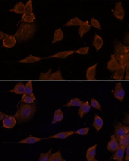 Western Blot: GNA11 Antibody [NBP3-35896] - Western blot analysis of various lysates using GNA11 Rabbit pAb at 1:1000 dilution. Secondary antibody: HRP-conjugated Goat anti-Rabbit IgG (H+L) at 1:10000 dilution. Lysates / proteins: 25 ug per lane. Blocking buffer: 3 % nonfat dry milk in TBST. Detection: ECL Basic Kit. Exposure time: 90s.