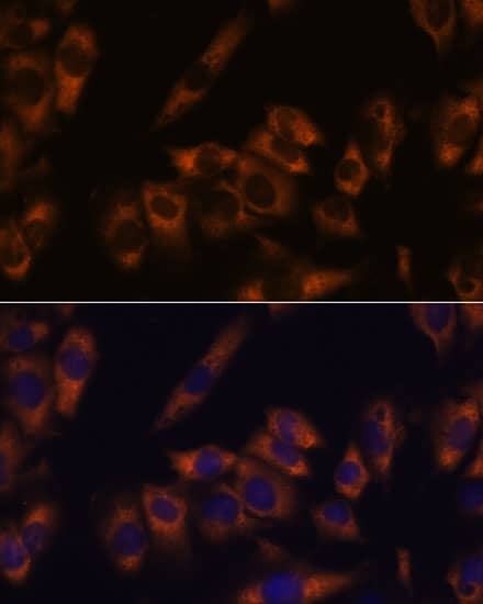 Immunocytochemistry/ Immunofluorescence GRID2 Antibody