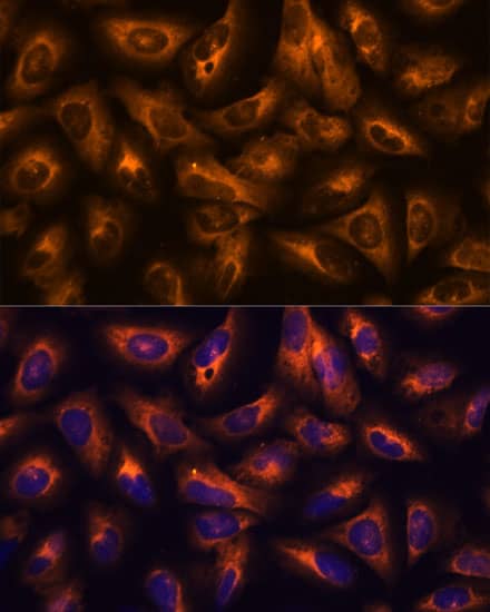Immunocytochemistry/ Immunofluorescence: GRID2 Antibody [NBP3-35897] - Immunofluorescence analysis of U-2 OS cells using GRID2 Rabbit pAb at dilution of 1:100. Secondary antibody: Cy3-conjugated Goat anti-Rabbit IgG (H+L) at 1:500 dilution. Blue: DAPI for nuclear staining.