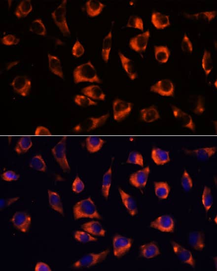 Immunocytochemistry/ Immunofluorescence GRID2 Antibody