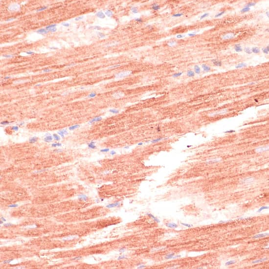 Western Blot: Mark3 Antibody [NBP3-35899] - Western blot analysis of lysates from SH-SY5Y cells using Mark3 Rabbit pAb at 1:1000 dilution.Secondary antibody: HRP-conjugated Goat anti-Rabbit IgG (H+L) at 1:10000 dilution.Lysates/proteins: 25 ug per lane.Blocking buffer: 3% nonfat dry milk in TBST.Detection: ECL Basic Kit.Exposure time:90s.