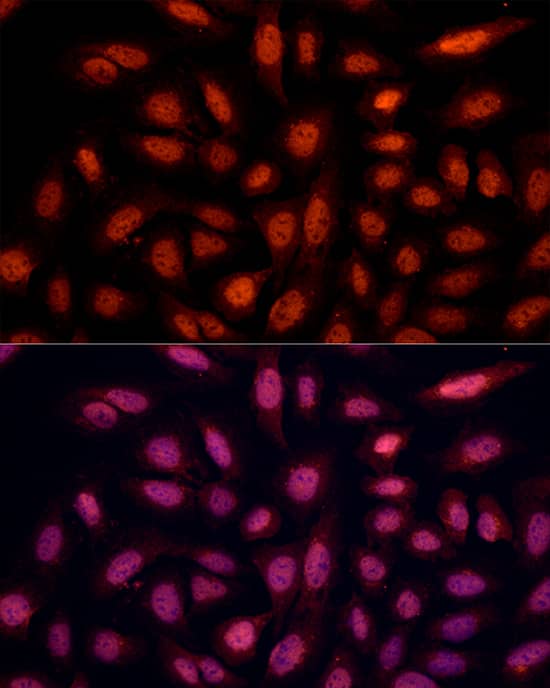 Immunocytochemistry/ Immunofluorescence BRN3B/POU4F2 Antibody