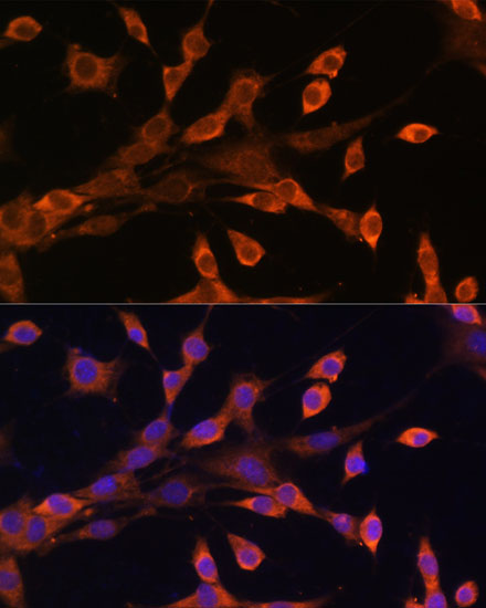 Immunocytochemistry/ Immunofluorescence: Protein Kinase A regulatory subunit I alpha Antibody [NBP3-35902] - Immunofluorescence analysis of NIH/3T3 cells using Protein Kinase A regulatory subunit I alpha Rabbit pAb at dilution of 1:100. Secondary antibody: Cy3 Goat Anti-Rabbit IgG (H+L) at 1:500 dilution. Blue: DAPI for nuclear staining.