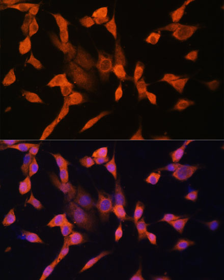 Immunocytochemistry/ Immunofluorescence: Protein Kinase A regulatory subunit I alpha Antibody [NBP3-35902] - Immunofluorescence analysis of NIH/3T3 cells using Protein Kinase A regulatory subunit I alpha Rabbit pAb at dilution of 1:100. Secondary antibody: Cy3 Goat Anti-Rabbit IgG (H+L) at 1:500 dilution. Blue: DAPI for nuclear staining.