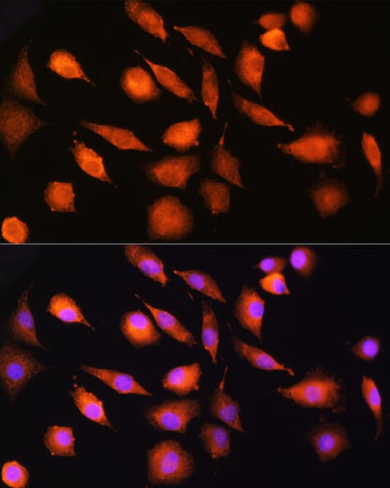 Immunocytochemistry/ Immunofluorescence: Ext2 Antibody [NBP3-35904] - Immunofluorescence analysis of L929 cells using Ext2 Rabbit pAb at dilution of 1:100 (40x lens). Secondary antibody: Cy3-conjugated Goat anti-Rabbit IgG (H+L) at 1:500 dilution. Blue: DAPI for nuclear staining.