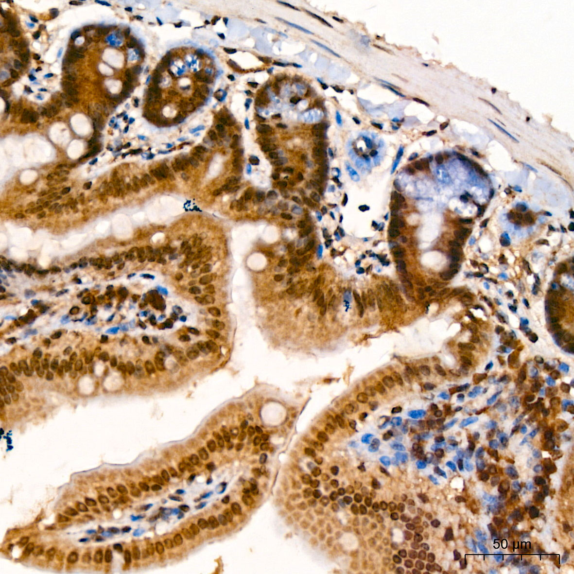 Immunohistochemistry: PSMB5 Antibody [NBP3-35905] - Immunohistochemistry analysis of PSMB5 in paraffin-embedded mouse Intestine tissue using PSMB5 Rabbit pAb at a dilution of 1:600 (40x lens). High pressure antigen retrieval was performed with 0.01 M citrate buffer (pH 6.0) prior to IHC staining.