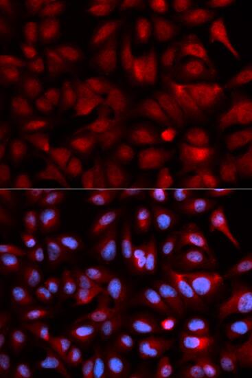 Immunohistochemistry: PSMB5 Antibody [NBP3-35905] - Immunohistochemistry analysis of paraffin-embedded Human breast tissue using PSMB5 Rabbit pAb  at a dilution of 1:600 (40x lens). High pressure antigen retrieval was performed with 0.01 M citrate buffer (pH 6.0) prior to IHC staining.