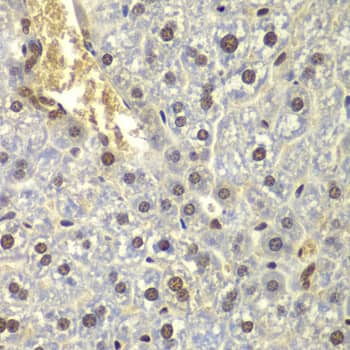 Immunohistochemistry: RPL5 Antibody [NBP3-35906] - Immunohistochemistry analysis of paraffin-embedded Mouse liver using RPL5 Rabbit pAb at dilution of 1:200 (40x lens). Microwave antigen retrieval performed with 0.01M PBS Buffer (pH 7.2) prior to IHC staining.