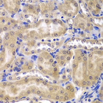 Immunohistochemistry: RPL5 Antibody [NBP3-35906] - Immunohistochemistry analysis of paraffin-embedded Mouse kidney using RPL5 Rabbit pAb at dilution of 1:200 (40x lens). Microwave antigen retrieval performed with 0.01M PBS Buffer (pH 7.2) prior to IHC staining.