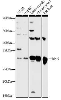 Western Blot: RPL5 Antibody [NBP3-35906] - Western blot analysis of various lysates using RPL5 Rabbit pAb at 1:500 dilution.Secondary antibody: HRP-conjugated Goat anti-Rabbit IgG (H+L) at 1:10000 dilution.Lysates/proteins: 25ug per lane.Blocking buffer: 3% nonfat dry milk in TBST.Detection: ECL Basic Kit.Exposure time: 60s.