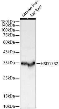 Western Blot: HSD17B2 Antibody [NBP3-35907] - Western blot analysis of various lysates, using HSD17B2 Rabbit pAb at  1:500 dilution.Secondary antibody: HRP-conjugated Goat anti-Rabbit IgG (H+L) at 1:10000 dilution.Lysates/proteins: 25ug per lane.Blocking buffer: 3% nonfat dry milk in TBST.Detection: ECL Basic Kit.Exposure time: 0.1s.