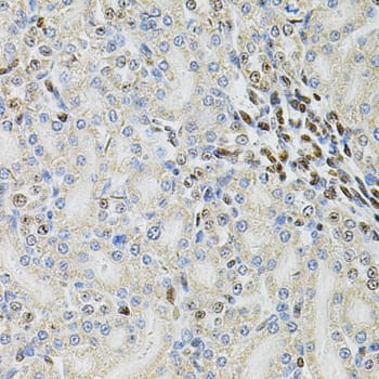 Immunohistochemistry: PSMC3 Antibody [NBP3-35909] - Immunohistochemistry analysis of paraffin-embedded Rat kidney using PSMC3 Rabbit pAb at dilution of 1:100 (40x lens). Microwave antigen retrieval performed with 0.01M PBS Buffer (pH 7.2) prior to IHC staining.