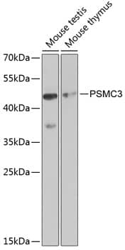 Western Blot: PSMC3 Antibody [NBP3-35909] - Western blot analysis of various lysates using PSMC3 Rabbit pAb at 1:1000 dilution.Secondary antibody: HRP-conjugated Goat anti-Rabbit IgG (H+L) at 1:10000 dilution.Lysates/proteins: 25ug per lane.Blocking buffer: 3% nonfat dry milk in TBST.